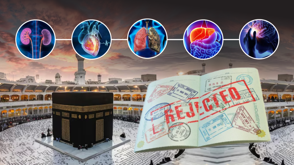 হজ ২০২৬: যেসব অসুস্থতায় মিলবে না ভিসা
